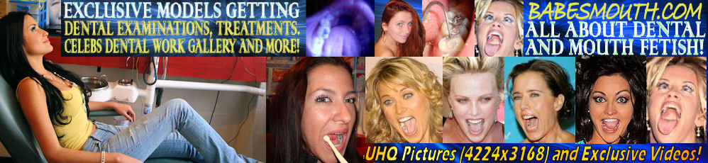 BabesMouth.com Beautiful celebs and girls showing their mouths, teeth, fillings, throats, tongues and all oral related! Dental images, dental cases.